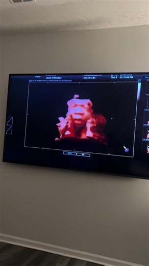 #spet3rd #baby2024 #pov #virl #pregnant #explore #babyfever #september #explorepage