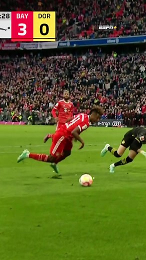 Kingsley Coman Football Injury: Bayern vs Dortmund