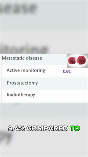 The Treatment Choice That Prevents Prostate Cancer Spread #prostatecancer #prostatehealth #treatment