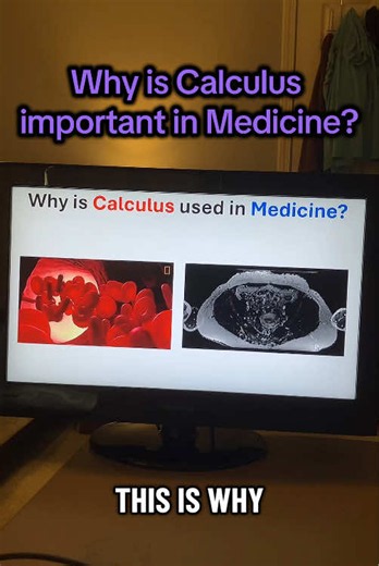 Why is Calculus important in Medicine? Share this video! Purchase my physics guide (link in bio)!