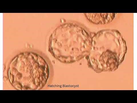 EMBRYO DEVELOPMENT