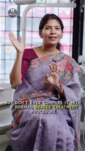 First Day With Aligners: What Really Happens? #aligners #smilecorrection