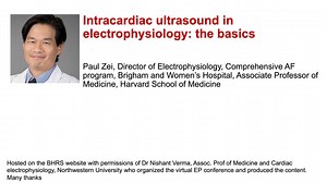 Intracardiac ultrasound in electrophysiology: the basics - British Heart Rhythm Society