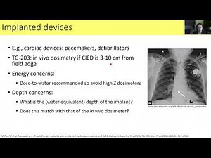 MedPhys - In-vivo dosimetry a practical guide