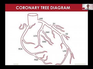 PCI vs CABG Surgery - How do we help our patients to choose? - Dr Stanley Chia