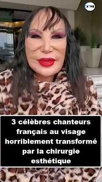 3 famous French singers whose faces have been horribly transformed by cosmetic surgery