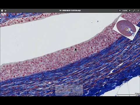 What epithelium looks like down the microscope