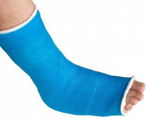 The Do's and Don'ts of Cast Care | Foot Doctor in Chanhassen