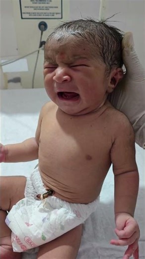 Moro Reflex in Newborn 😱#shorts #newborn #nicucare #babycare #nicu #trending #hospitalcare #baby