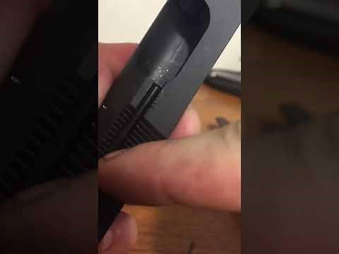 SA-35: how to fix extraction issue in autistic detail