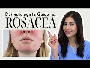 Rosacea Explained: Causes, Treatments & Skincare Tips from a Dermatologist