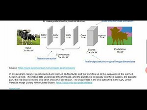 Medical Image Segmentation Using SegNet in Matlab. IP Credit in description