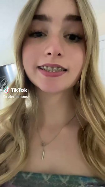 BRACESSS #rubylishous #fyp #trend #relatable #spam #spamaccount #viral #silly #braces #teeth
