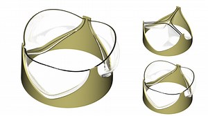 Fluid-structure interaction (FSI) of a Trileaflet Heart Valve - Simcenter