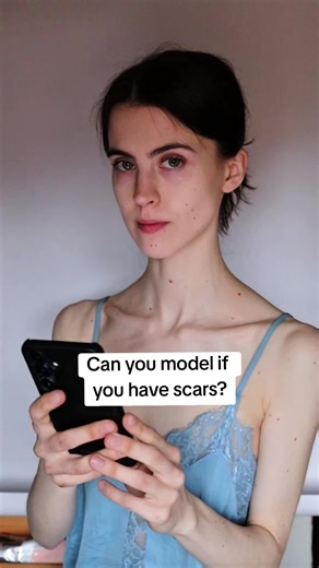 Scars in Modeling: Are They a Problem or Advantage?