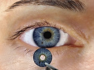 CUSTOMFLEX® ARTIFICIALIRIS by Human Optics - Kestrel Ophthalmics