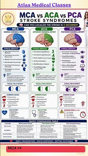 MCA vs ACA vs PCA STROKE SYNDROMES | Brain Stroke: MCA, ACA, ICA, PCA, Vertebrobasilar Artery Stroke