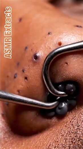 ASMR Extracts | Perfect Pore Pull