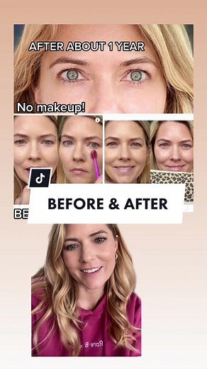 Transform Your Skin with Beauty Devices