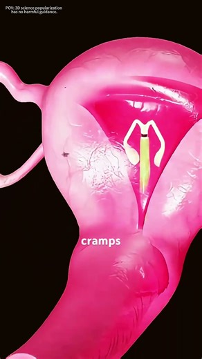 How Intrauterine Device(IUD) Is Inserted And How It Works? #music #motivation #iudinsertion