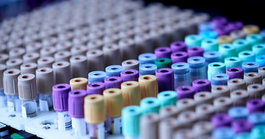 Monocytes : quel est le taux normal et quel taux ne pas dépasser ?