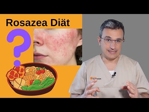Rosazea: Iss das besser nicht. Tipps zur Ernährung von Hautarzt. Dr. Kasten Hautmedizin in Mainz