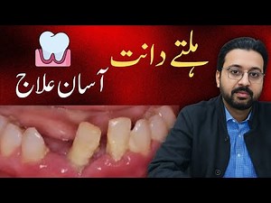 How to STOP Loose Teeth Naturally at Home | Gum Strengthening Tips by Dentist