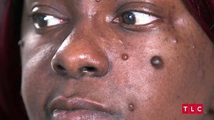 419K views · 1.6K reactions | One of my FAVORITE patients is on the new episode of Dr Pimple Popper, on @tlc tomorrow, Thursday 9/8c. Who’s watching?! ✌❤️#drpimplepopper | Dr Sandra Lee aka drpimplepopper | Facebook