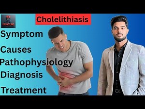 Cholelithiasis (Gallstones) | Causes, Symptoms, Diagnosis & Treatment Explained