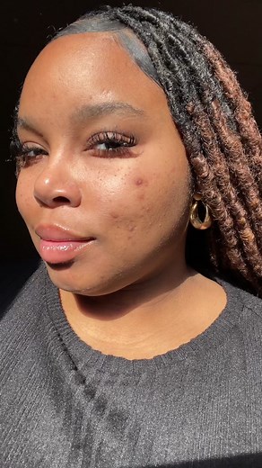 Skinfix Skin Barrier Restoring Gel Cream Review