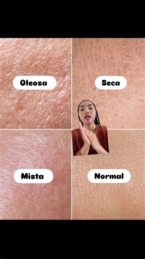 Tipos de pele. #pov #fyp #skincomsandra #angola🇦🇴portugal🇵🇹brasil🇧🇷mocambique🇲🇿