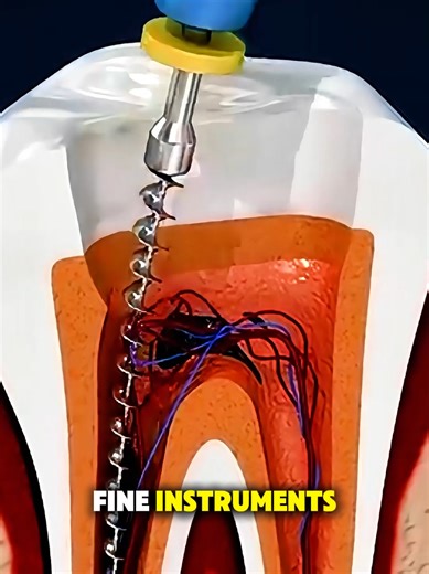 Understanding Root Canal Treatment: A Step-by-Step Guide