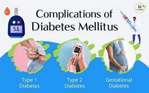 Everything You Need To Know About Complications Of Diabetes