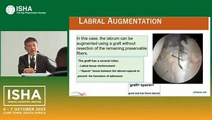 Evolving Hip Arthroscopic Management for Hip Capsule and Labral Preservation: Repair, Reconstruction, Augmentation