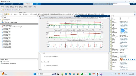 【ECG心电信号】基于matlab高通滤波器+带通滤波器心电信号QRS波检测（含自相关 噪声水平 信号水平 自适应阈值 心率）【含Matlab源码 9951期】