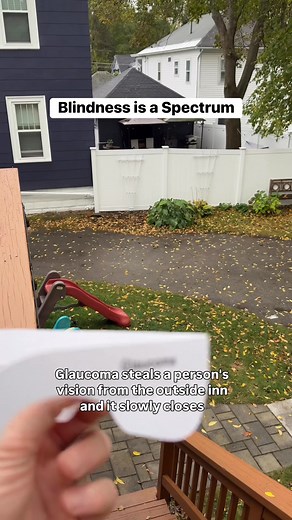 562K views · 9.6K reactions | Most people think being blind means...