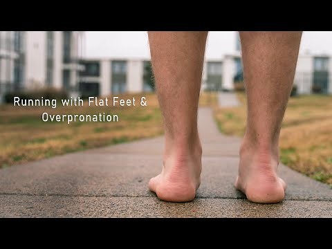 Running With Flat Feet and Overpronation