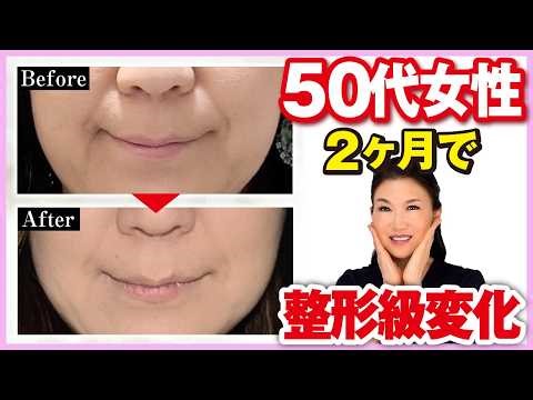 [Laugh lines] How a woman in her 50s looked younger in just 2 months! The ultimate lifting techni...