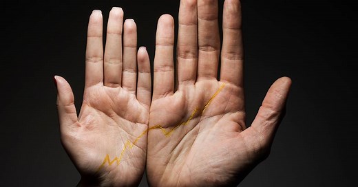 O que é a acromegalia, doença rara que faz a pessoa crescer demais