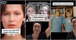 Plastic Surgeon Proves 'Fox Eye' Trend Was Sparked By Asian Features on TikTok