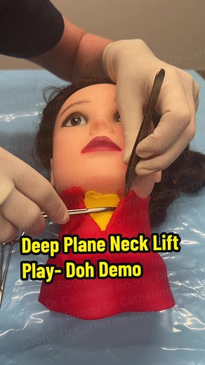 Deep Plane Neck Lift: Play-Doh Surgery Demonstration