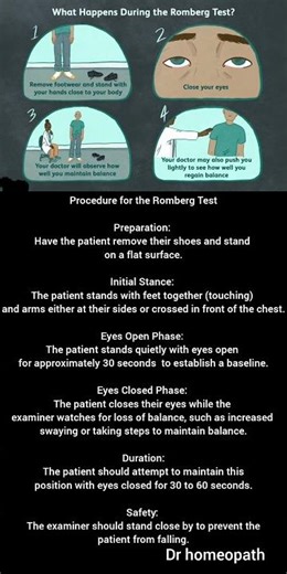 romberg test #medicine clinical examination