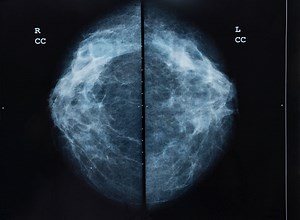 Brain MRI scan. Scanning of brain's magnetic resonance image