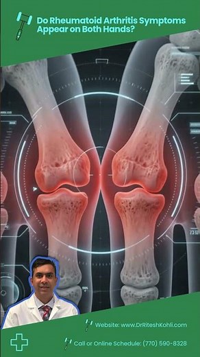 Do Rheumatoid Arthritis Symptoms Appear on Both Hands? | Ritesh Kohli | Rheumatologist | Marietta