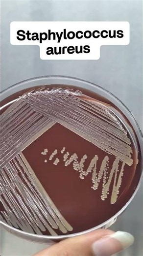 S.aureus🦠#StaphylococcusAureus #Microbiology #Bacteriology #GramPositiveCocci #BloodAgar