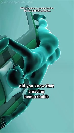 59K views · 129 reactions | Stapled Haemorrhoidectomy using the PPH System 勞 #3DAnimation #Stapled #Haemorrhoidectomy #PPH #clips | knowledge hunter | Facebook