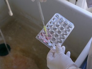 Neutrophil Isolation and Analysis to Determine their Role in Lymphoma Cell Sensitivity to Therapeutic Agents