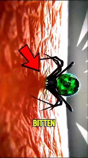 Spider Bite? Do NOT Panic (Do This Instead)