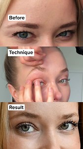 Lift Heavy Eyebrows for Open Eyes: Release Scalp & Brow Tension