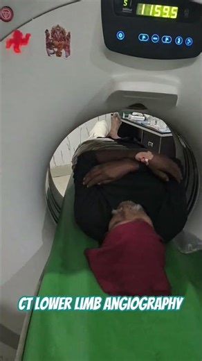 CT lower limb angiography